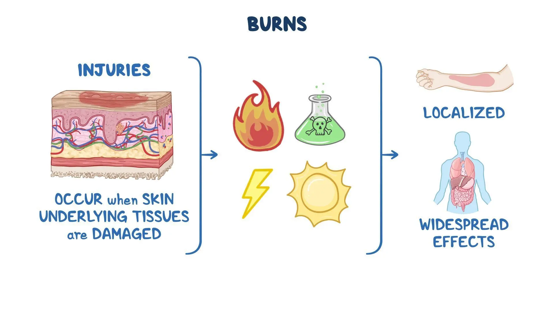 Understanding Bumassburner Leaks: Causes, Risks